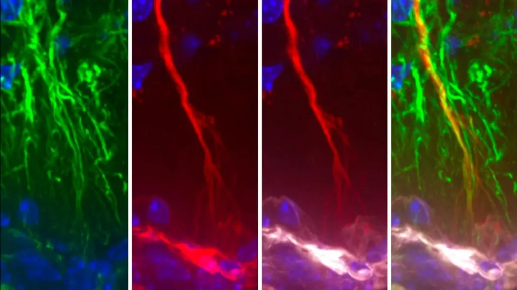 Celule neobservate anterior ar putea ajuta la eliminarea proteinei tau implicate în Alzheimer